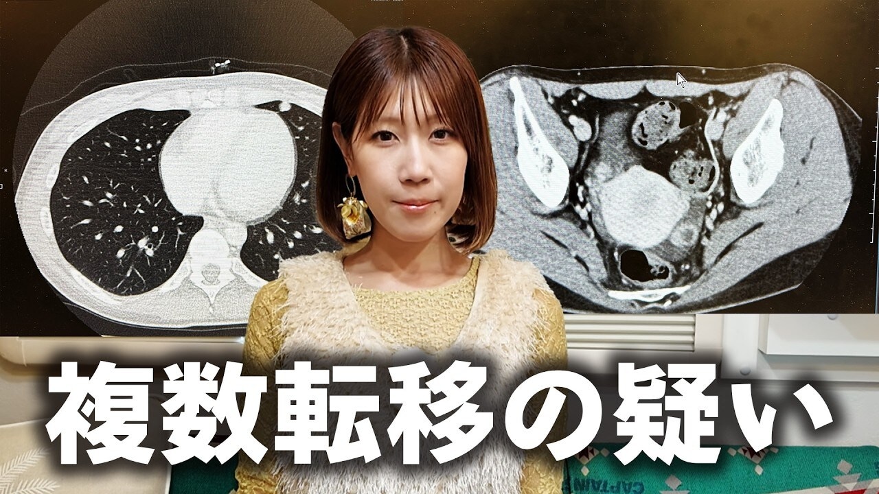 画像出典：YouTube（https://www.youtube.com/watch?v=yMFwi7tSWJ0）