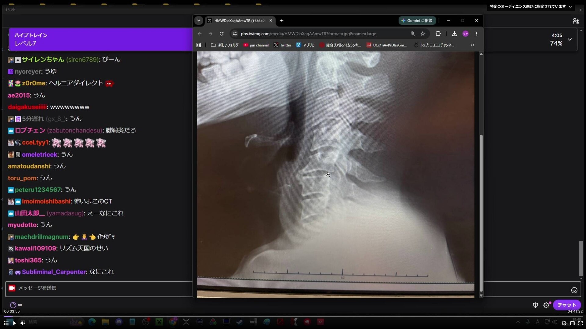 画像出典：Twitch（https://www.twitch.tv/videos/2812650942）