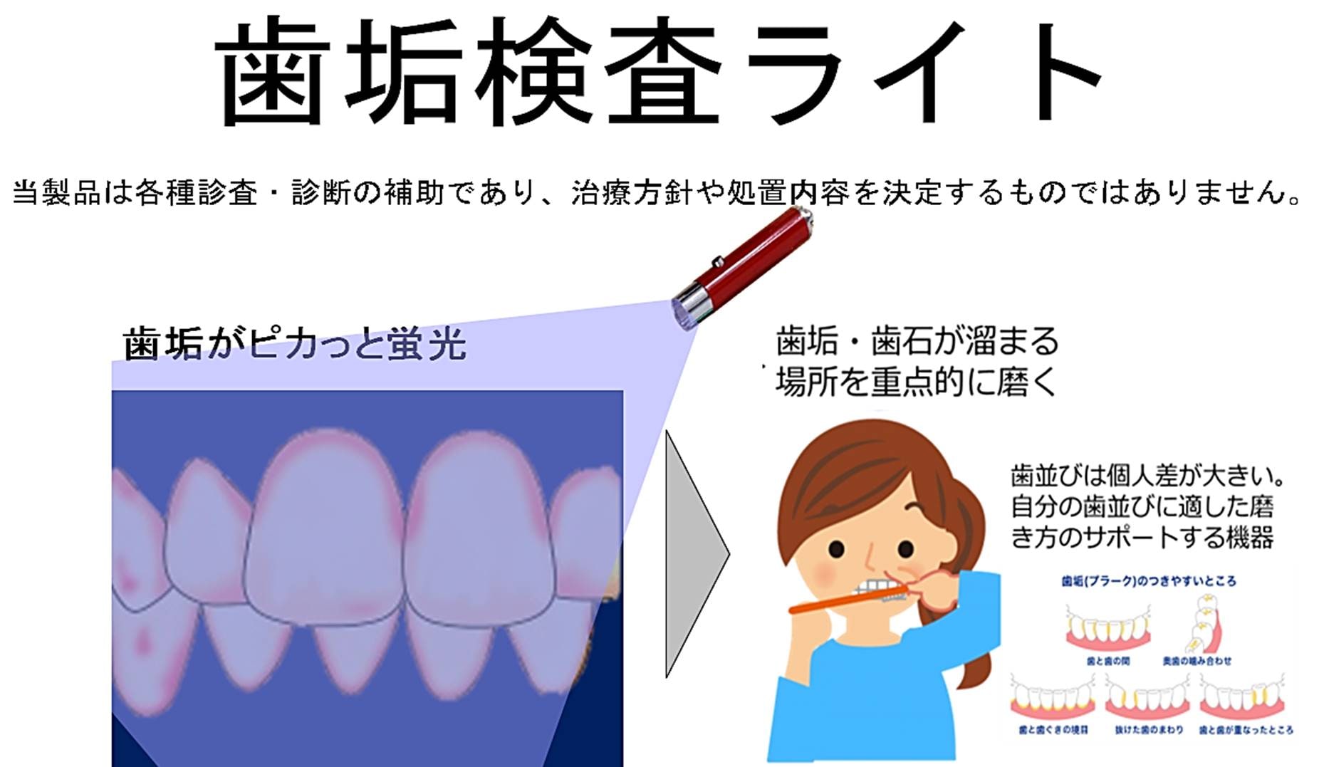 歯垢検査ライト　～100歳まで健康な歯を保つ新しいライフスタイル習慣～