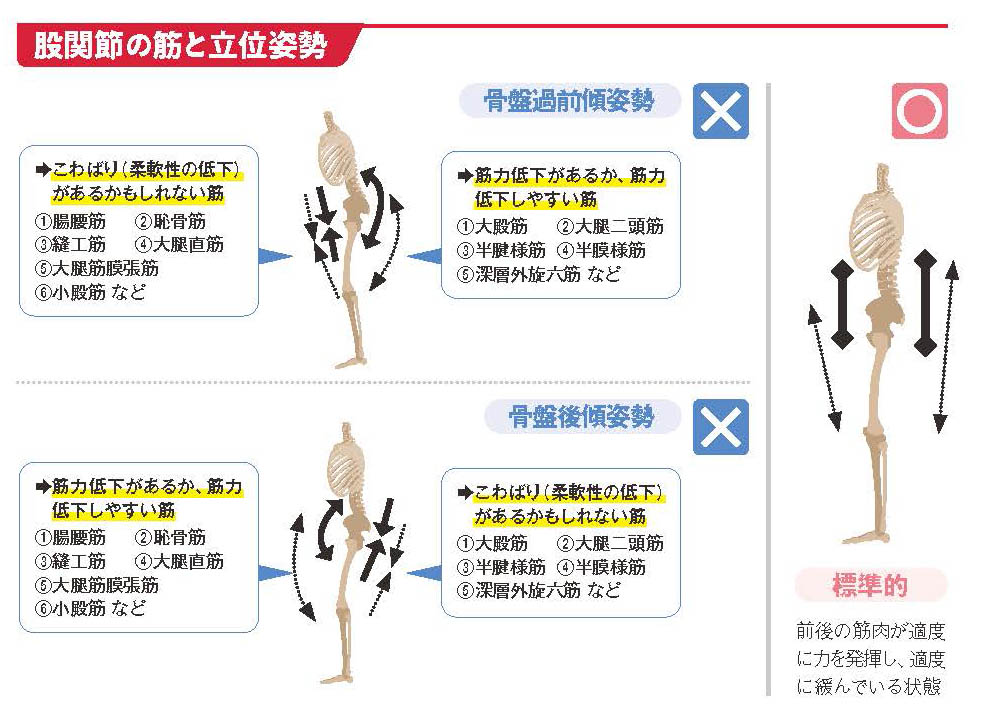 股関節の筋と立位姿勢【スポーツ障害予防の教科書】