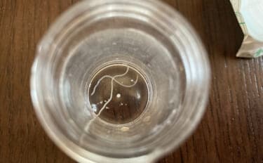 アニサキス中毒は「鮮度の問題」ではなかった　「P型」は安全で「S型」が危ない？