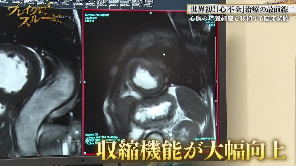 記事画像