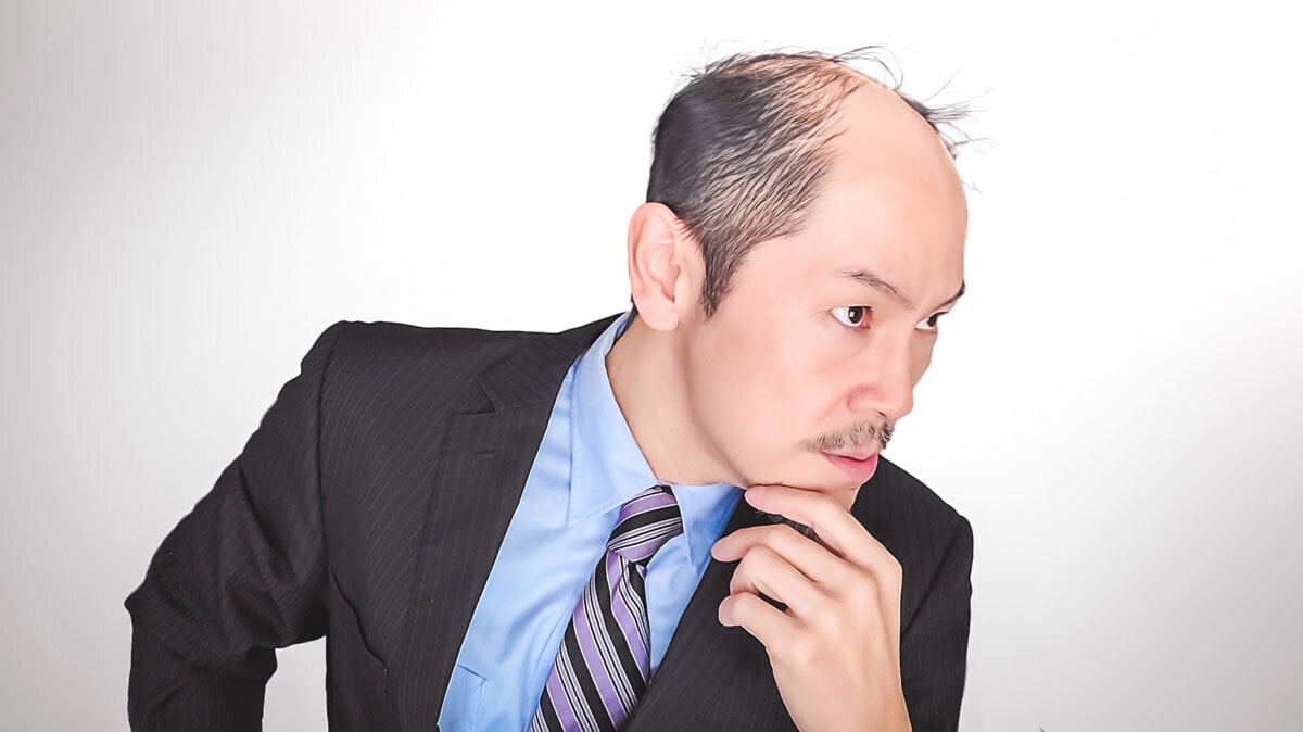 古くから経験的に知られてきた「母方の祖父がハゲなら孫にも遺伝する」は医学的にも正しいという