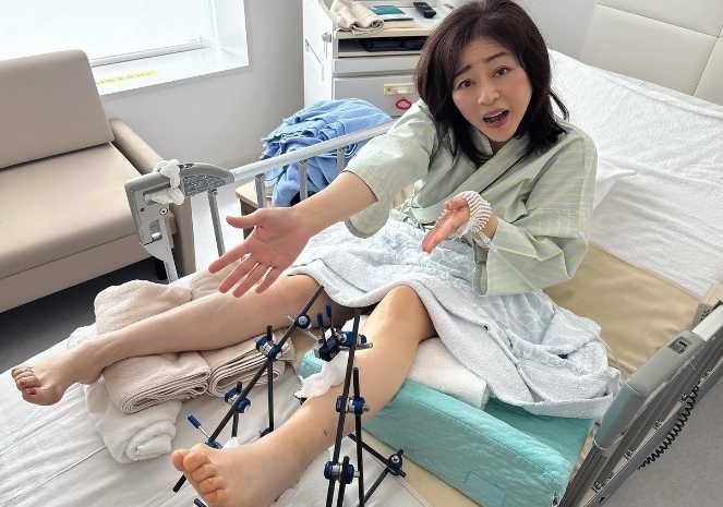 Instagram:松本明子(@akkotongattelne)より