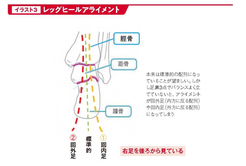 レッグヒールアライメント【スポーツ障害予防の教科書】