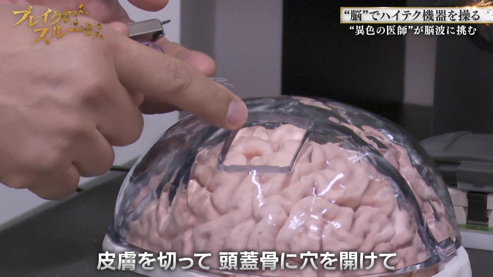 記事画像
