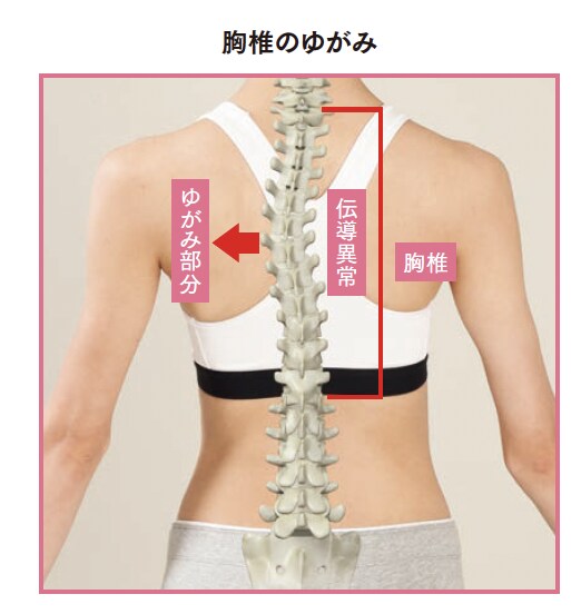 胸椎のゆがみ【背骨コンディショニング】