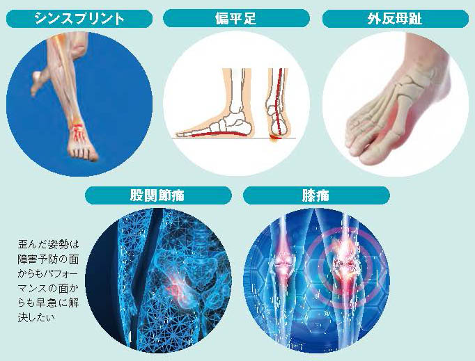 姿勢の歪みはパフォーマンスにも影響する【スポーツ障害予防の教科書】