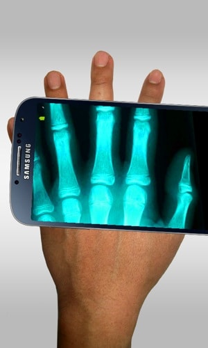 Xray Scanner